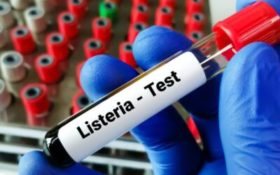 Guía de Medidas de Prevención y Control de la listeria en los Establecimientos Alimentarios